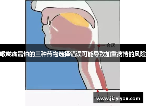 喉咙痛最怕的三种药物选择错误可能导致加重病情的风险